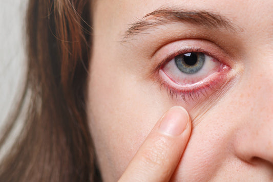 How Long Does Pink Eye Last