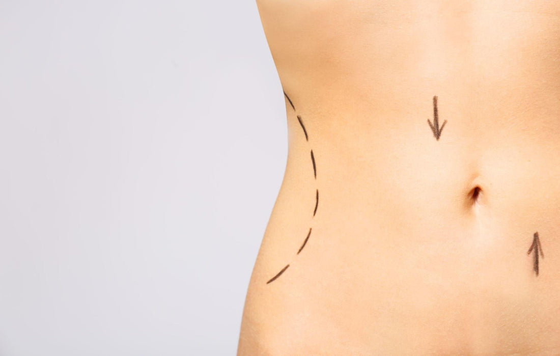 How Long Does Body Contouring Last? [Answered] - Vision Source Rio